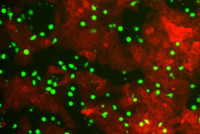 Fluoreszenzaufnahme von NK-Zellen (grün) und Kolonkarzinomzellen (rot). Foto: Uni Halle
